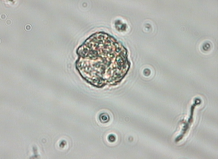 Dictyocha speculum